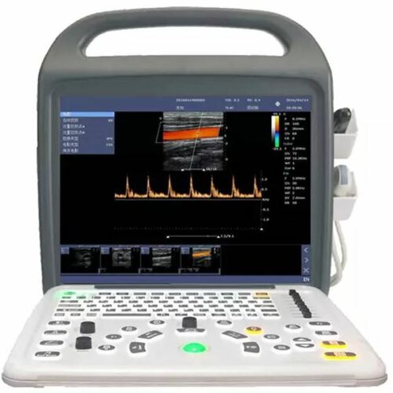 Portable Color Doppler Ultrasound Scanner